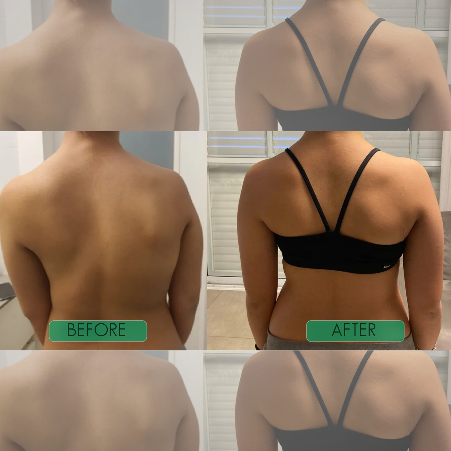 Haarlosy™ Instant Posture Corrector - Transform Your Health