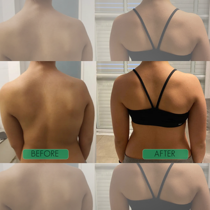 Haarlosy™ Instant Posture Corrector - Transform Your Health
