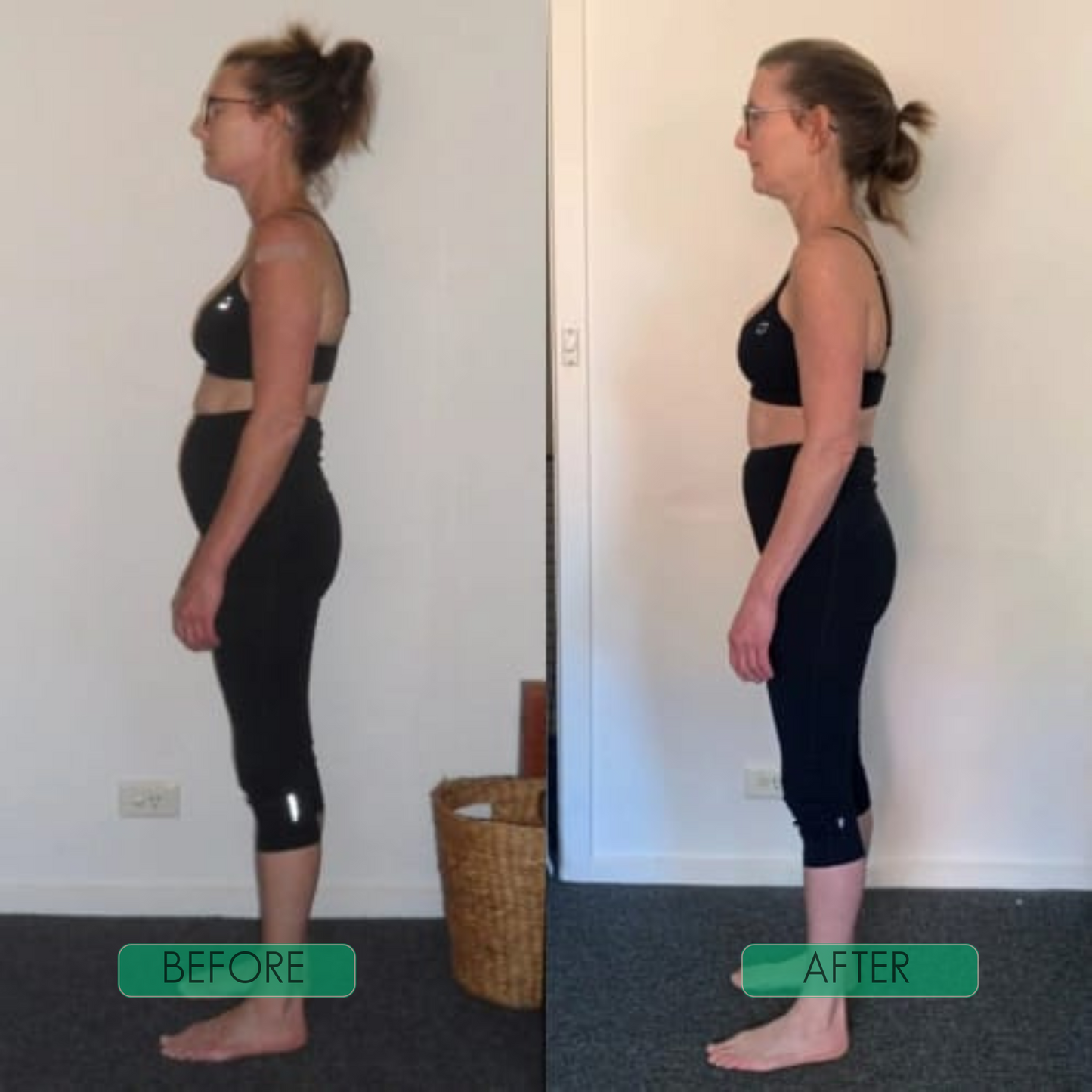 Haarlosy™ Instant Posture Corrector - Transform Your Health